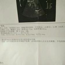 孕34周后胎儿还会长多少