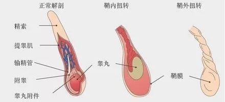 一侧睾丸疼痛是怎么回事