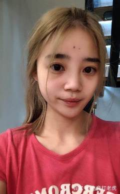 哪儿看痘痘好