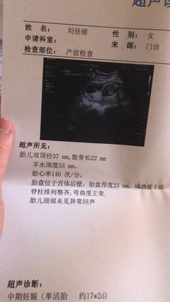 怎么测试男女宝宝最准