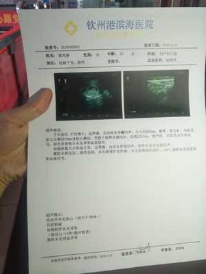 怀孕两个月孩子多大