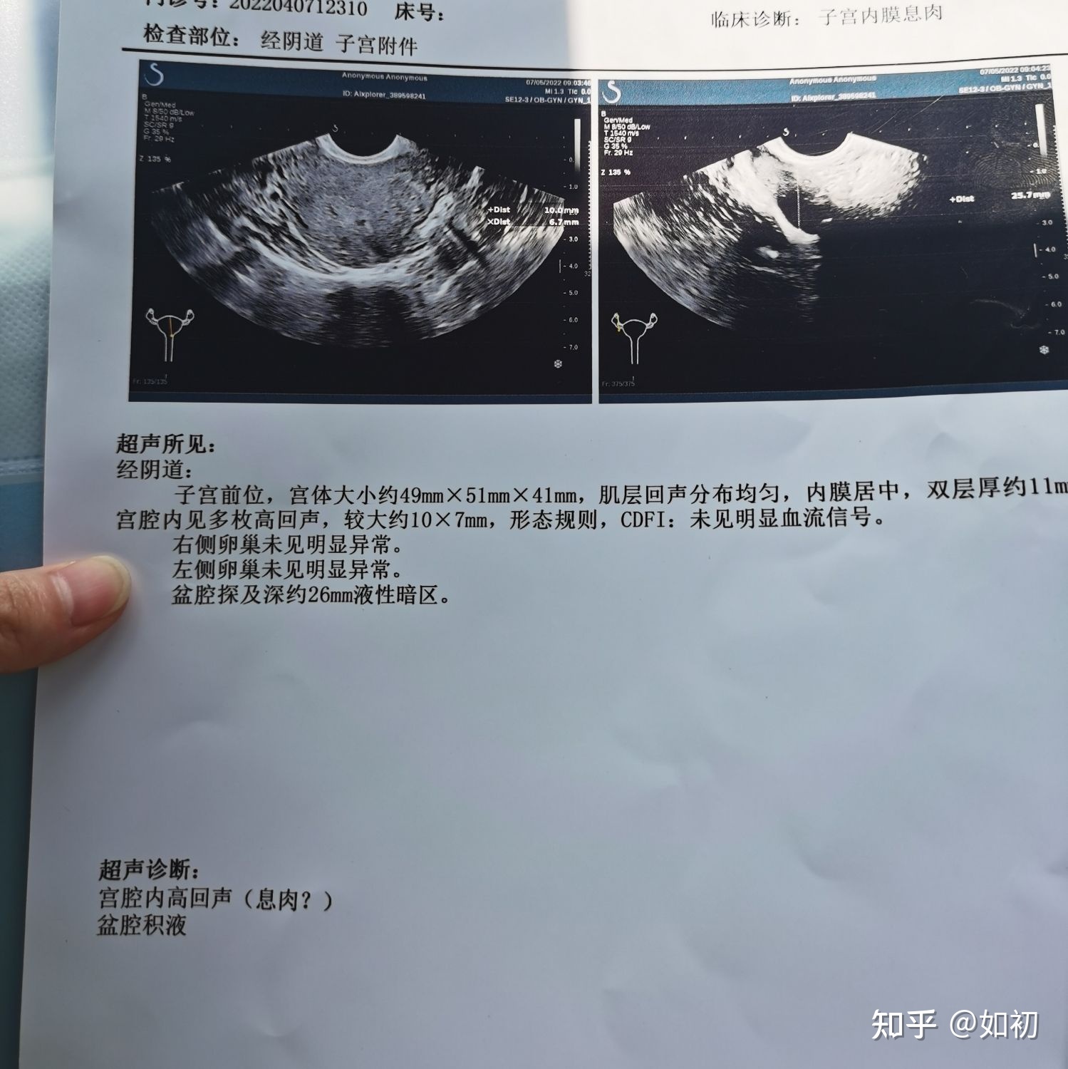 内膜厚怎么治疗