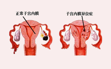 月经不调怀孕的几率大不大