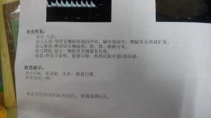 孕36周后胎儿一周一般能长重