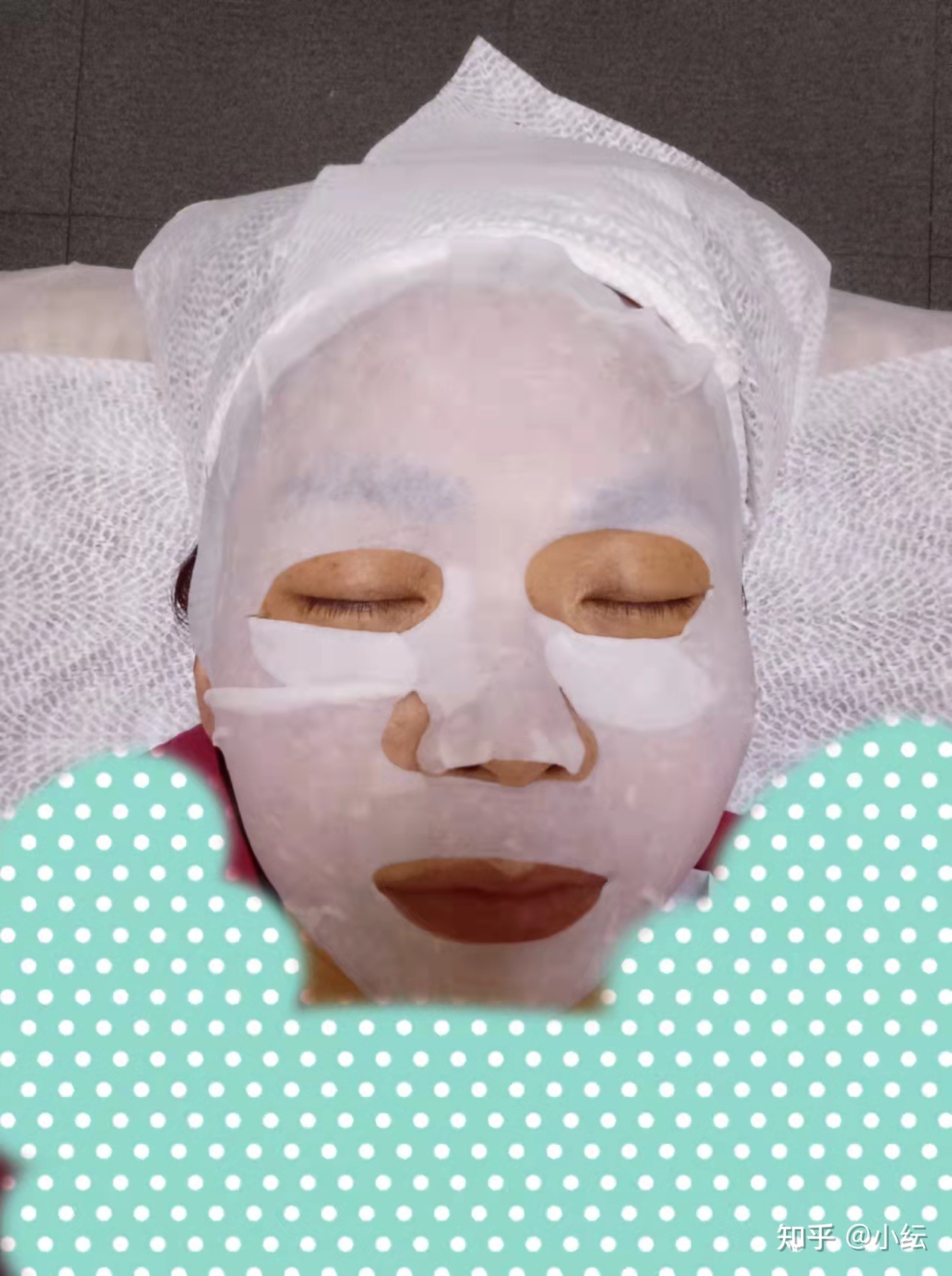 皮秒祛斑后的注意事项