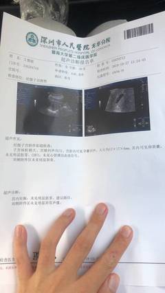 怀孕五周见红怎么回事