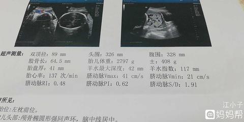 34周胎儿头围多少正常吗