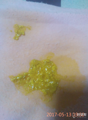 刚出生宝宝一天拉几次大便为正常