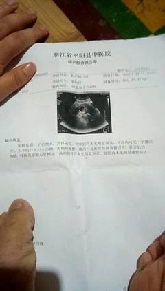 怀孕2个月最准看男女