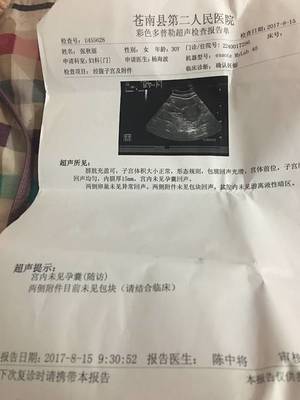 怀孕四十天彩超图片