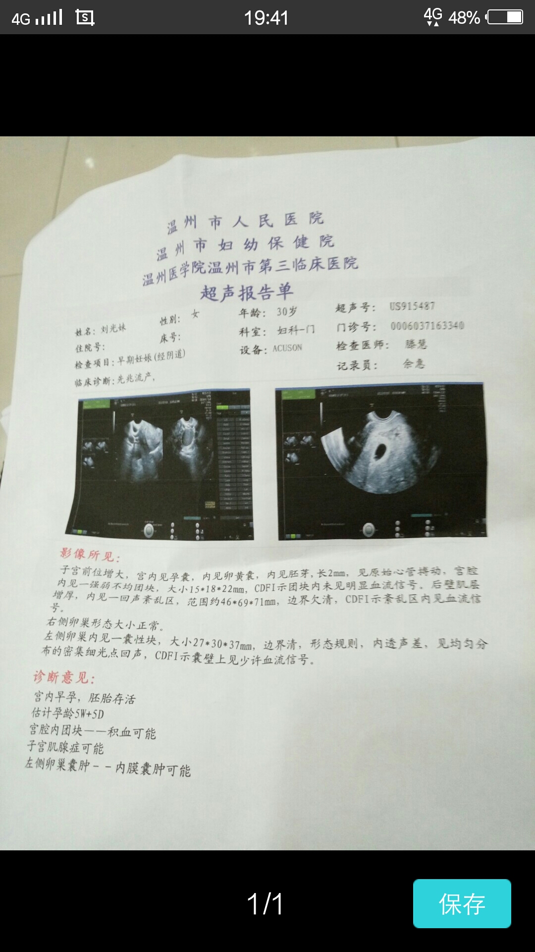 怀孕40天孩子多大