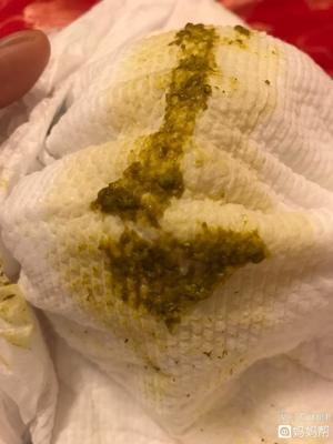 屎是白色的怎么回事