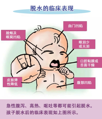 新生儿肠胃炎