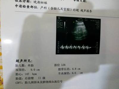 怀孕35周还有多久生产