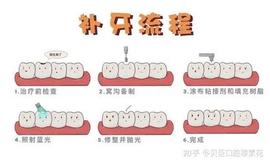 补牙注意