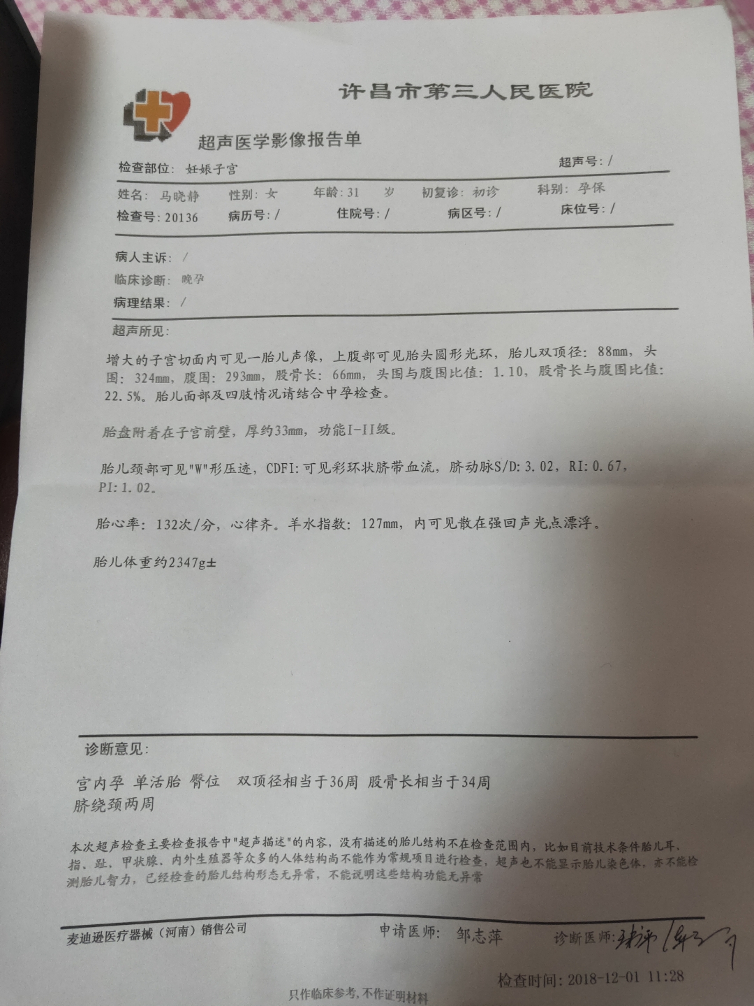 36周胎儿真实图片