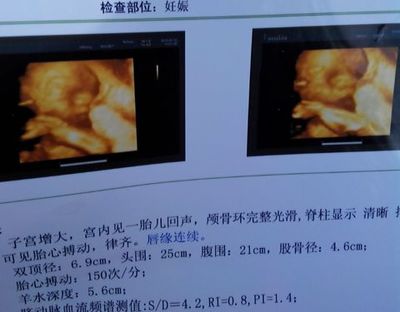 怀孕六个月做四维晚吗