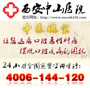 口腔溃疡权威医院
