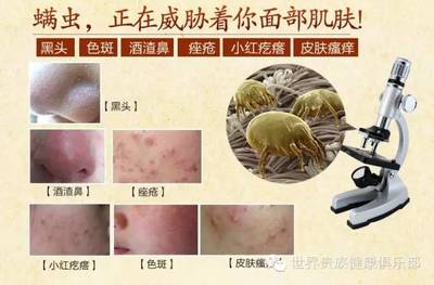怎样区别是痘痘还是螨虫