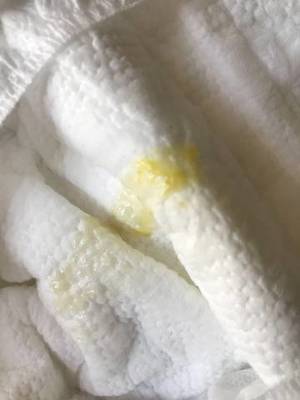 宝宝拉的粑粑黏糊糊的
