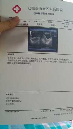 怀孕几天能看到孕囊
