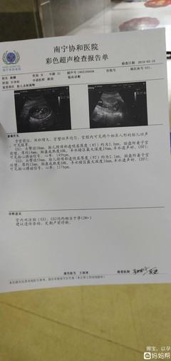 多囊怀孕