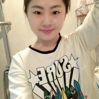 发痘痘忌口