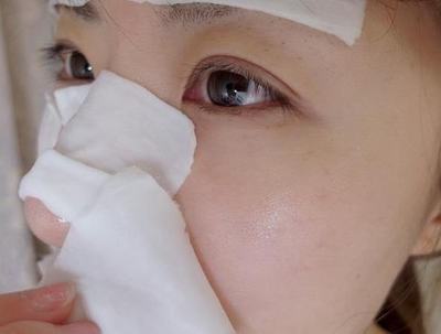 贴面膜张痘痘是为什么