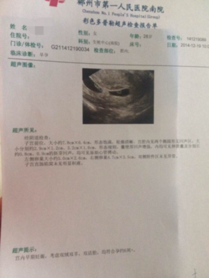 孕妇胎儿心跳多少正常
