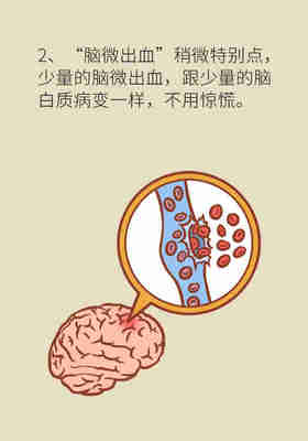 脑梗是怎么回事