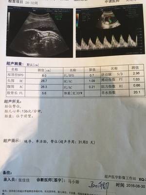 孕30周头大多少正常值