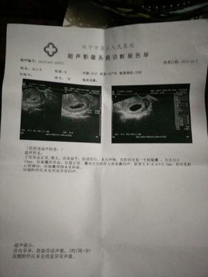 孕吐越厉害胎儿越稳定