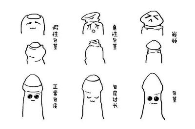 包皮浮肿是怎么回事