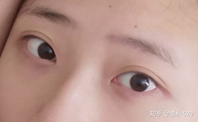 上眼皮厚的人面相