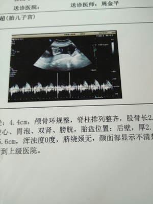 四个半月的胎儿有多大