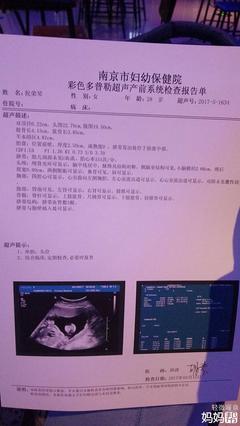 胎儿系统超声检查是什么