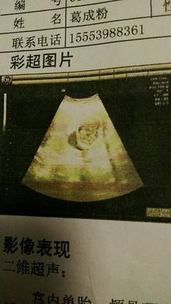 一个月就有孕吐正常吗
