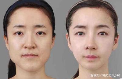 瘦脸针打50单位少了吗