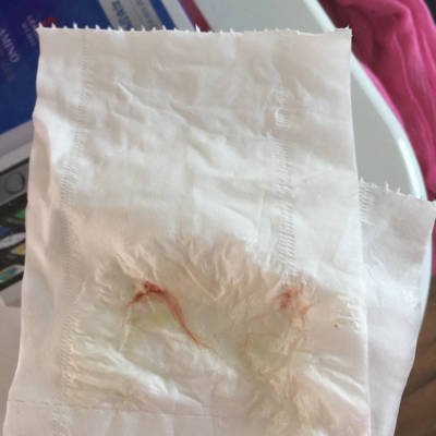 怀孕会分泌白带吗