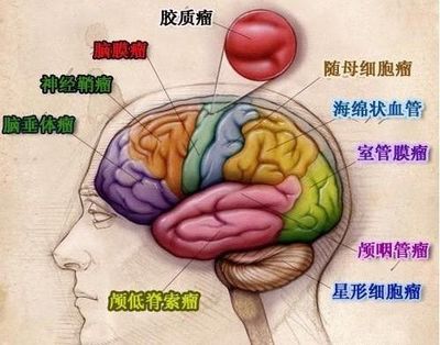 脑梗阻怎么治疗