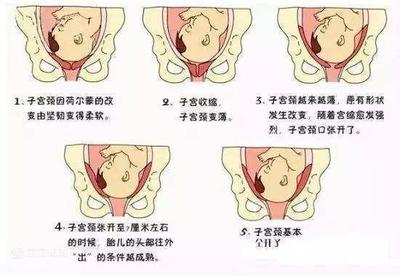 怎么让胎儿入盆