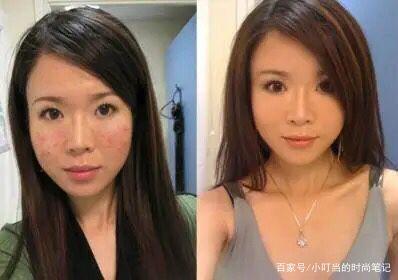 打瘦脸多久见效果明显