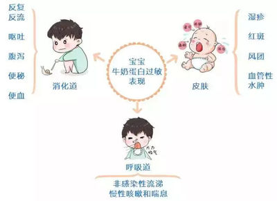 宝宝蛋白质过敏症状