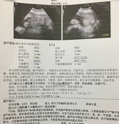 怀孕6个月胎儿图片