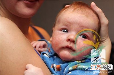 新生儿腹胀怎么办