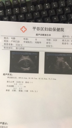 宝宝多重正常