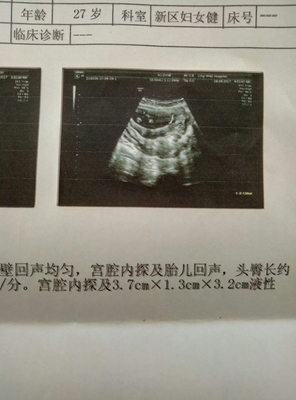 怀孕三个月胎儿位置图