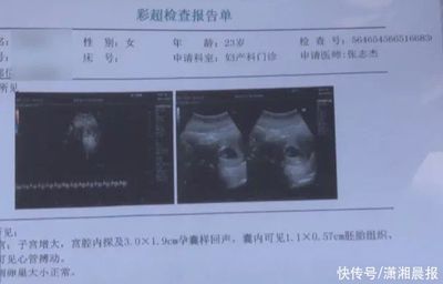 全麻之后多久可以怀孕