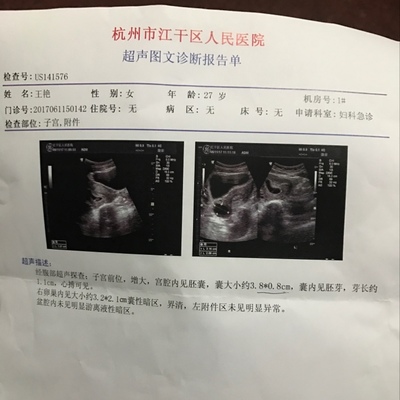 怀孕8周胎芽多大正常
