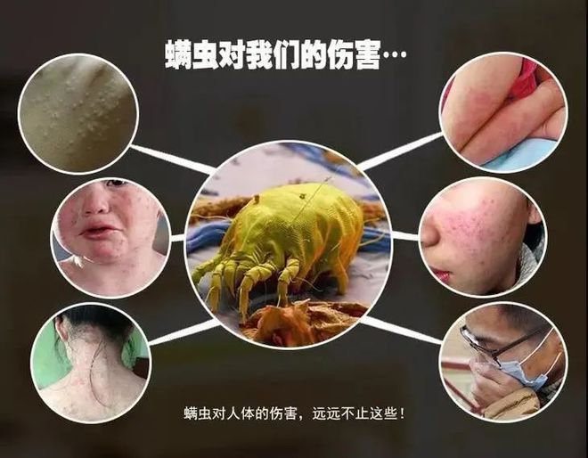 怎样区别是痘痘还是螨虫